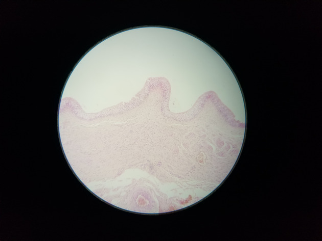 Transitional Epithelium Slides - Transitional Epithelium 01 400X